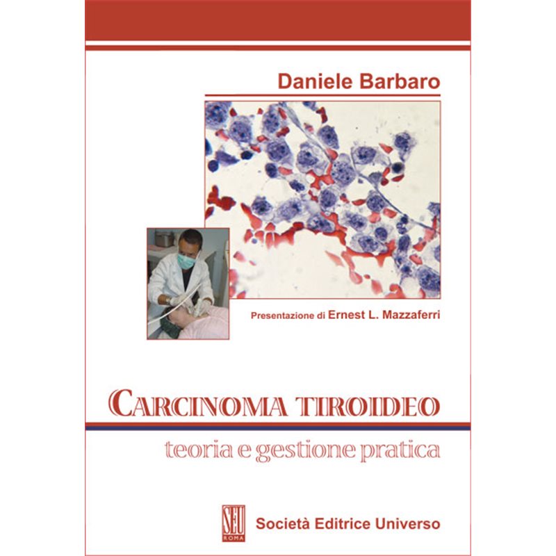 Carcinoma Tiroideo